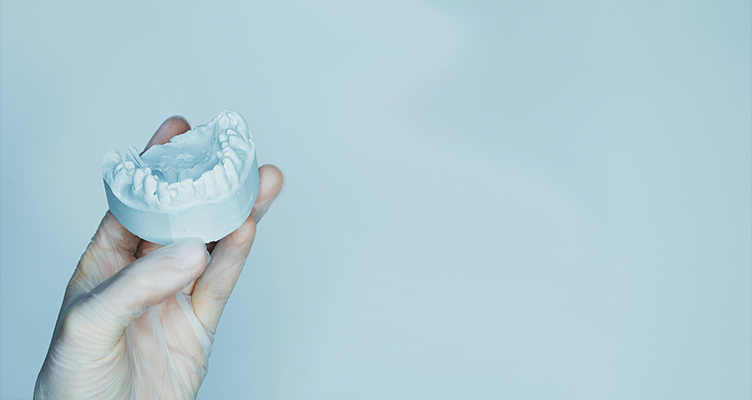 Dental Inlays in San Mateo