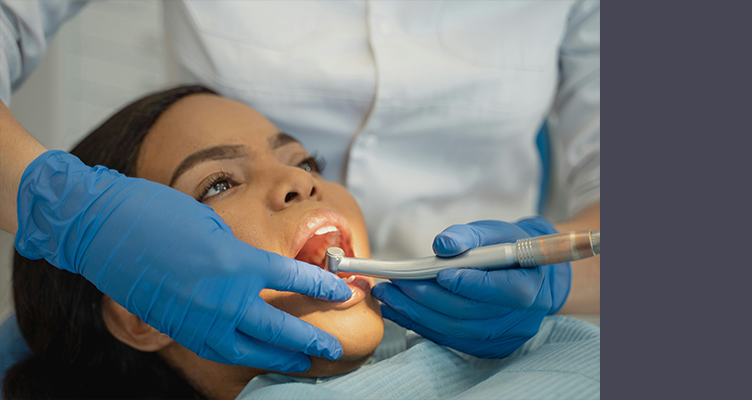 Dental Fillings in San Mateo 